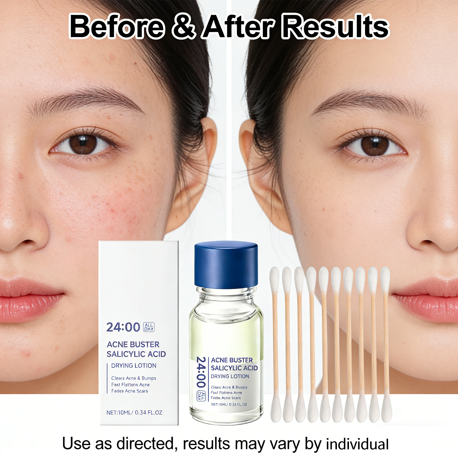 Salicylic Acid Drying Lotion A - Azelaic Acid Cream incelemesi ve fiyatı