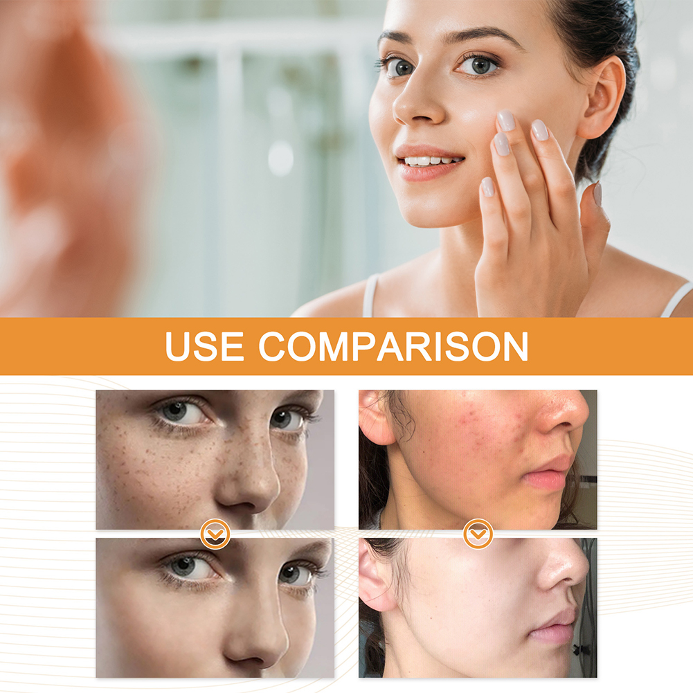 30ml 120% Vitamins C+E Ferulic - Ferulic Acid Serum incelemesi ve fiyatı