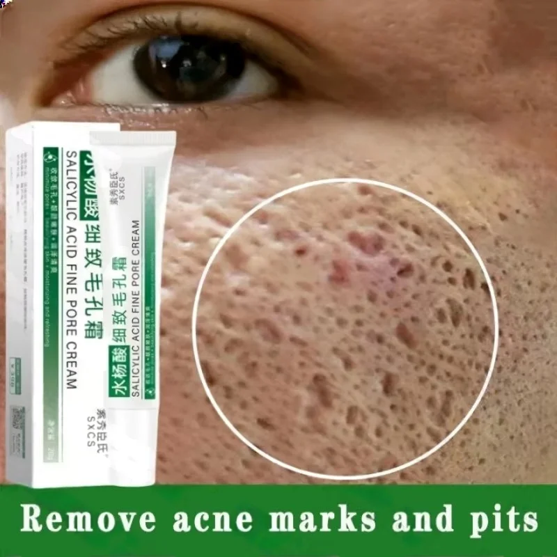 Salicylic Acid Pore Clearing C - Azelaic Acid Cream incelemesi ve fiyatı