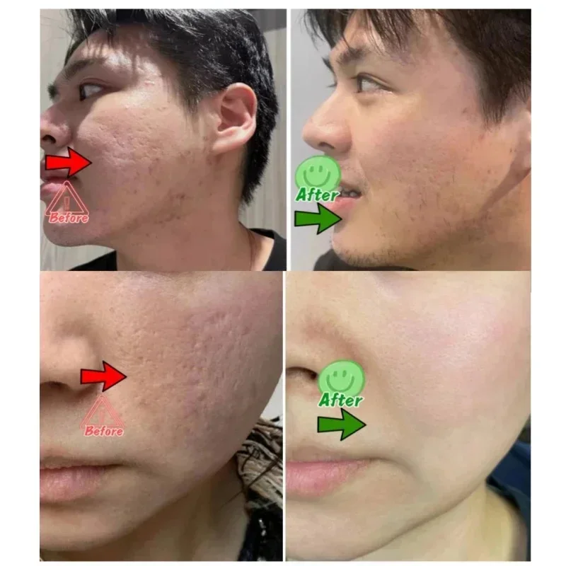 Salicylic Acid Pore Clearing C - Azelaic Acid Cream incelemesi ve fiyatı