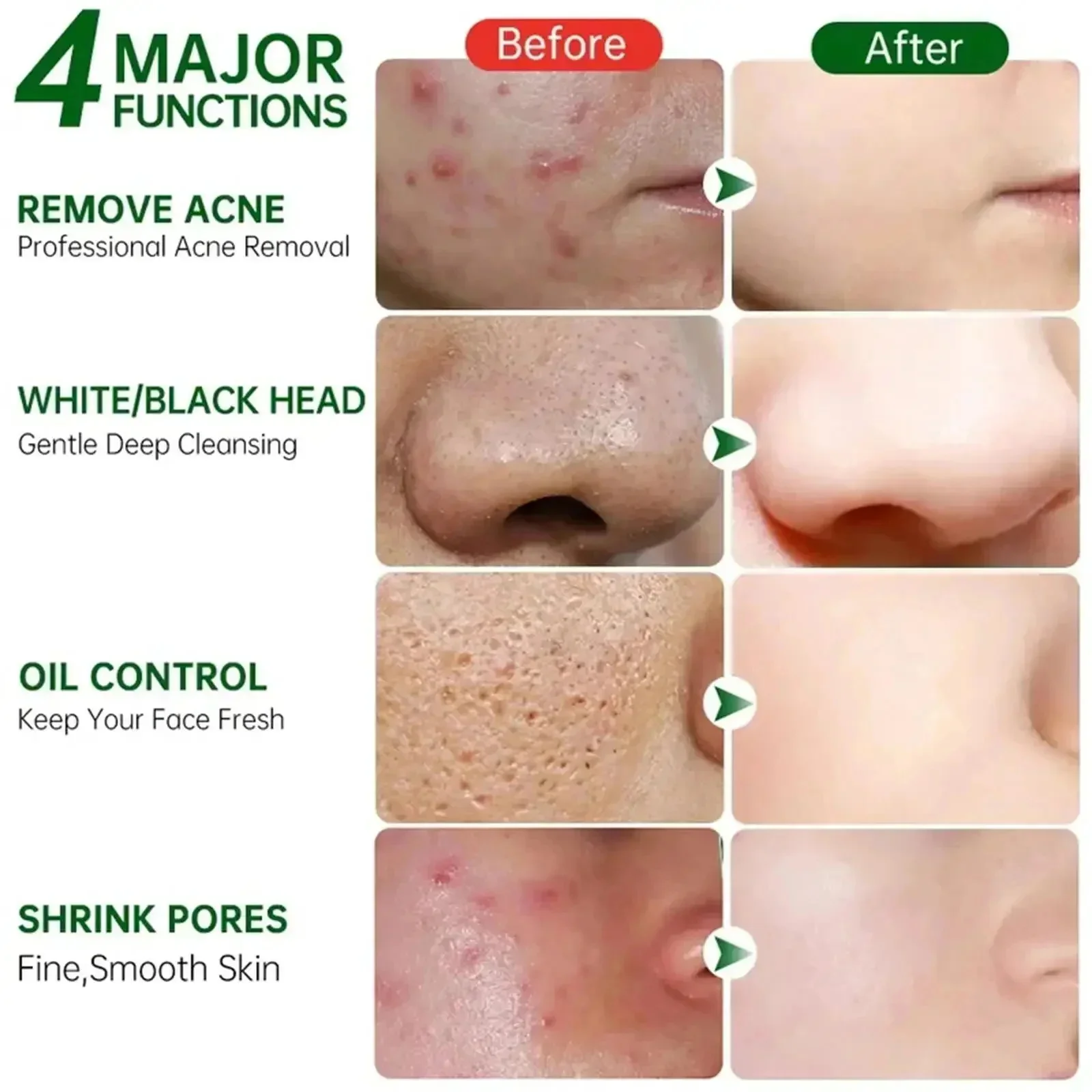 Salicylic Acid Pore Clearing C - Azelaic Acid Cream incelemesi ve fiyatı