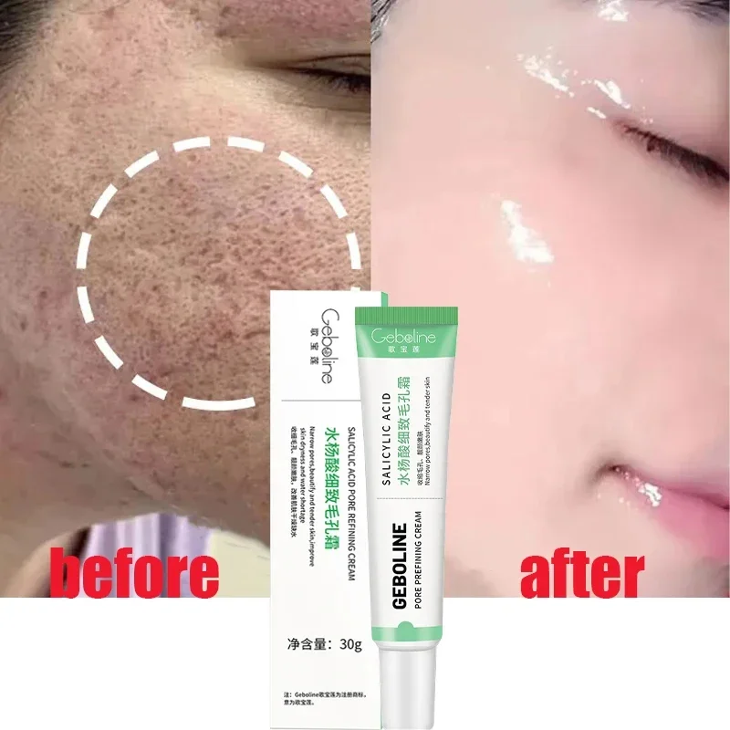 Salicylic Acid Pore Shrinking  - Azelaic Acid Cream incelemesi ve fiyatı