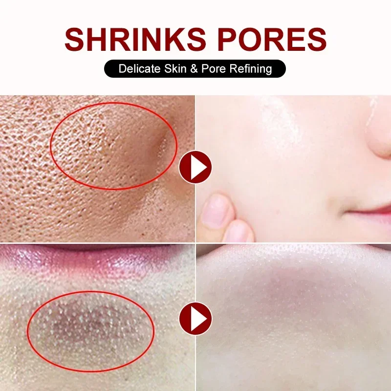 Salicylic Acid Pore Shrinking  - Azelaic Acid Cream incelemesi ve fiyatı