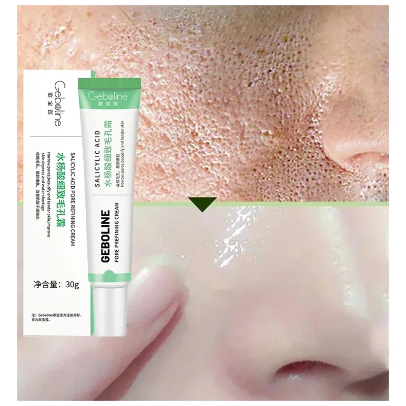 Salicylic Acid Pore Shrinking  - Azelaic Acid Cream incelemesi ve fiyatı