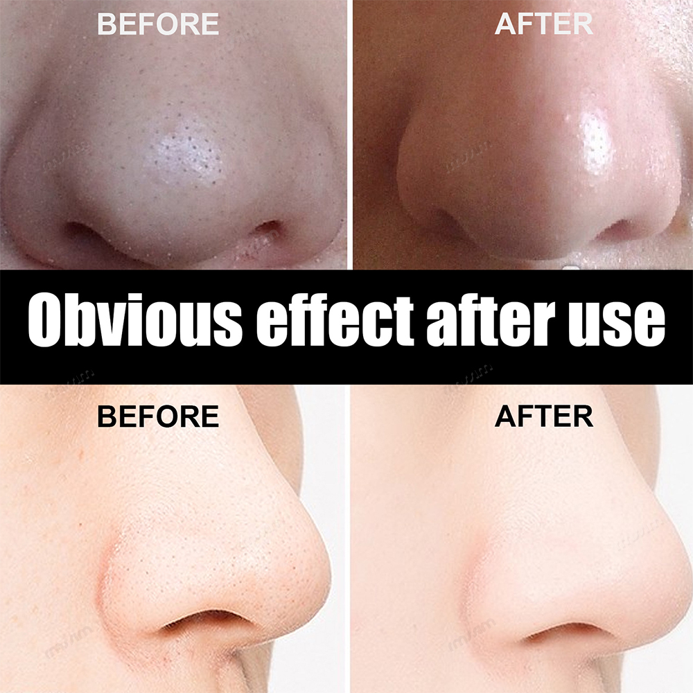 New 10-100pcs Unisex Blackhead - Skincare Indonesia incelemesi ve fiyatı